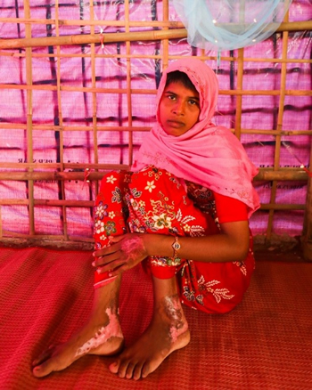 Rohingya girl